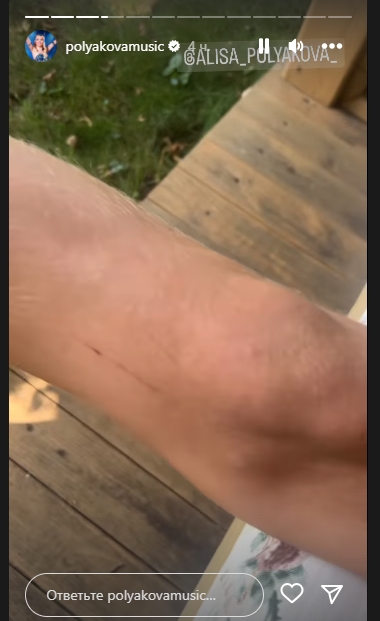 10 з 10. Українські зірки показують себе справжніх, не соромлячись "вад": фото і відео